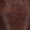 Roak